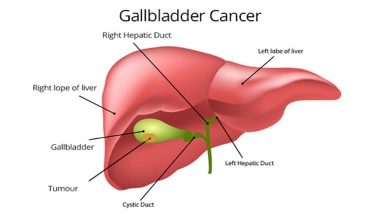 The Liver and Gallbladder