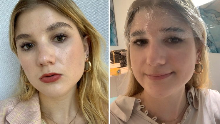 How to Get a Permanent Brow Lift?