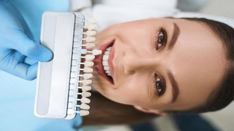 How to Get a New Smile
