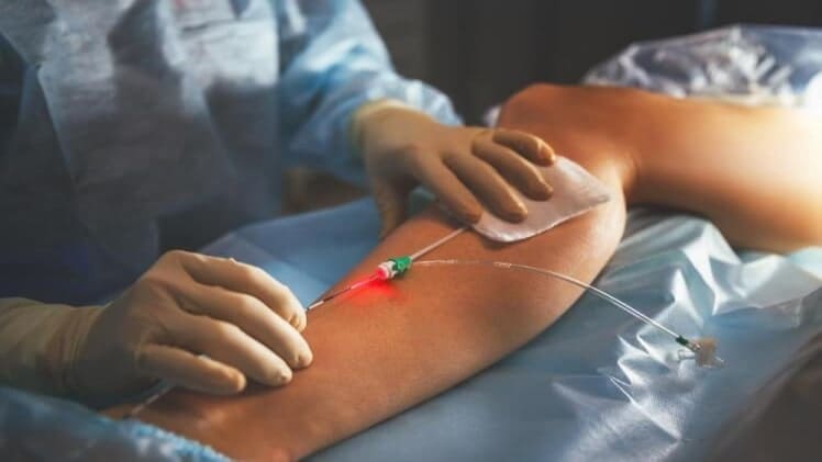 What Happens When You Go to a Vascular Doctor?